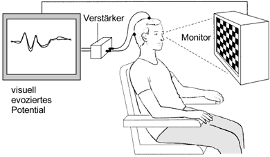 Visuell evozierte Potentiale (VEP) zur Untersuchung des Sehnerven. (aus neurotransconcept.com)